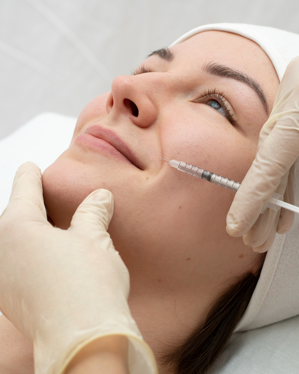 Acne Programme