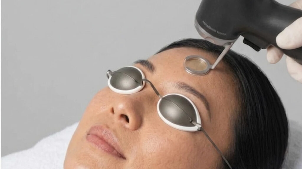 Acne Programme