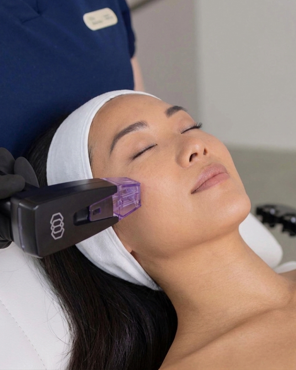 Acne Scars Programme