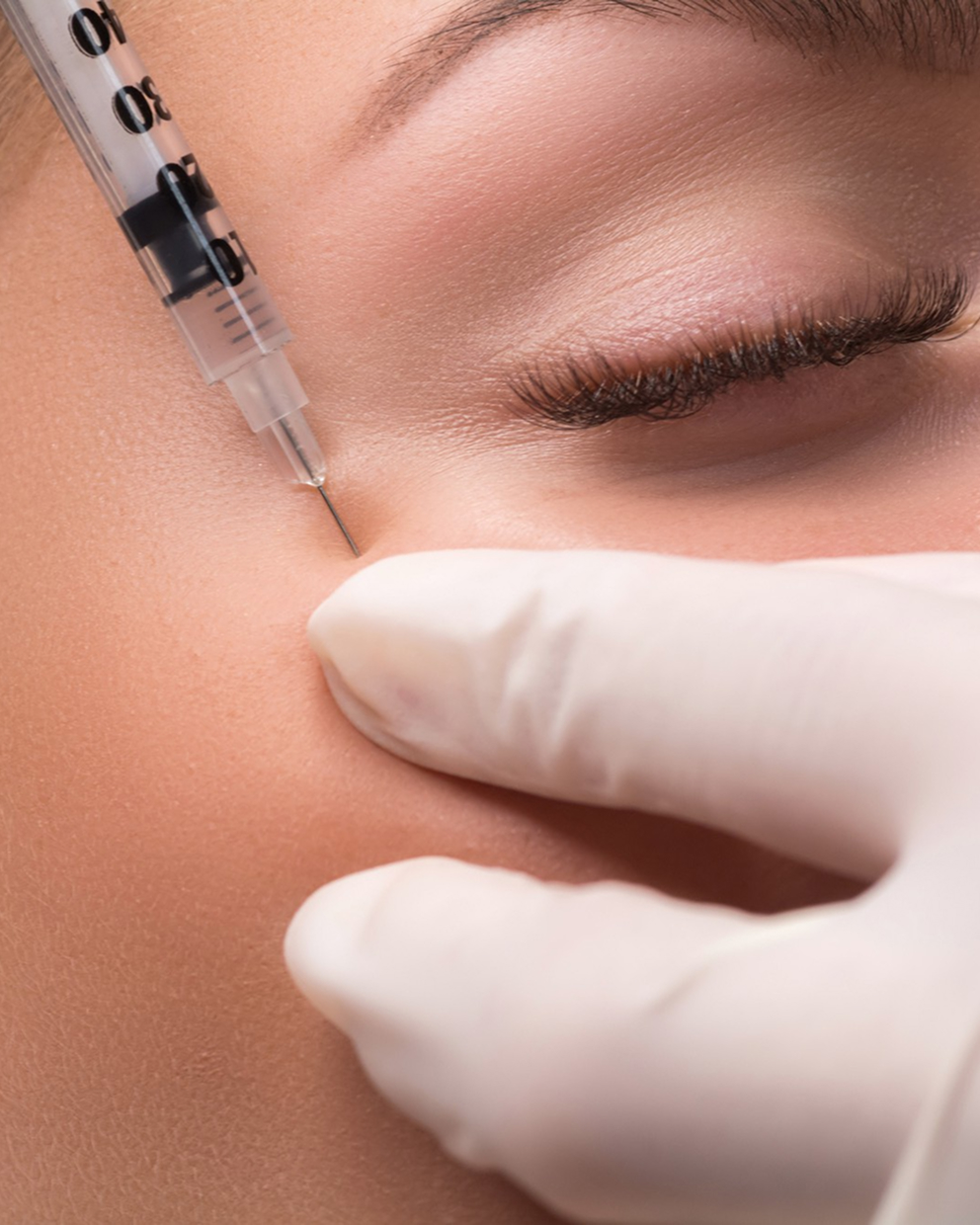 PLLA Skin Booster