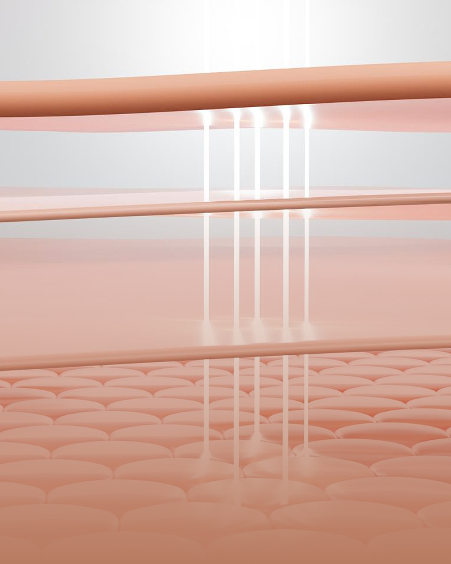 Illustration of energy passing through the skin into the deep support layers