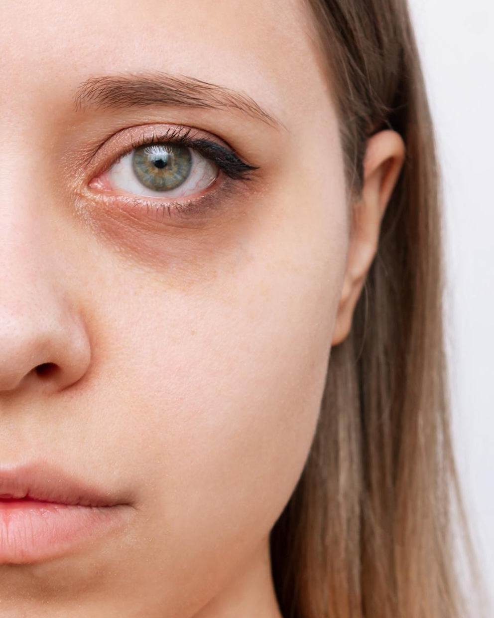 Eye Bag