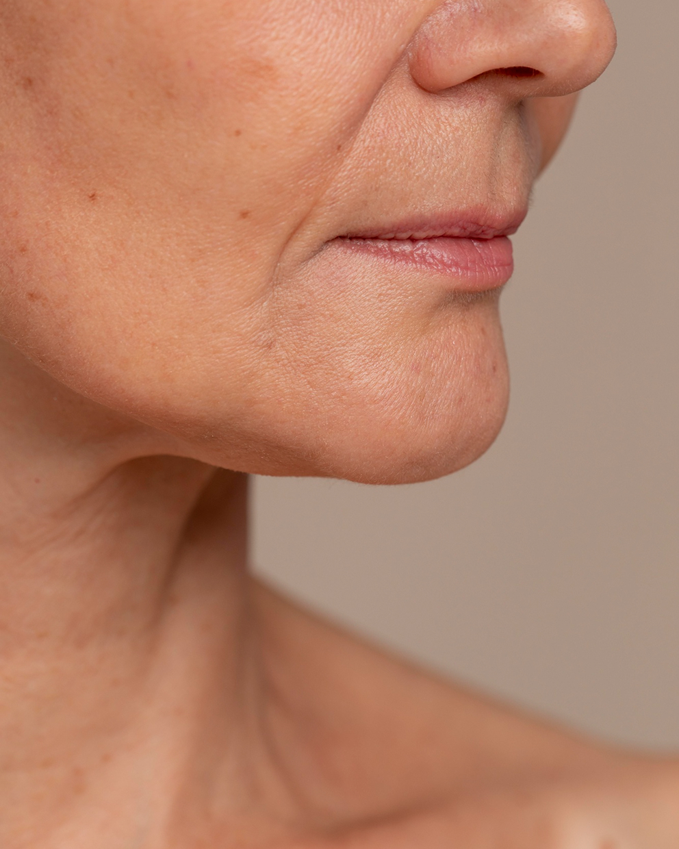 Facial Sagging