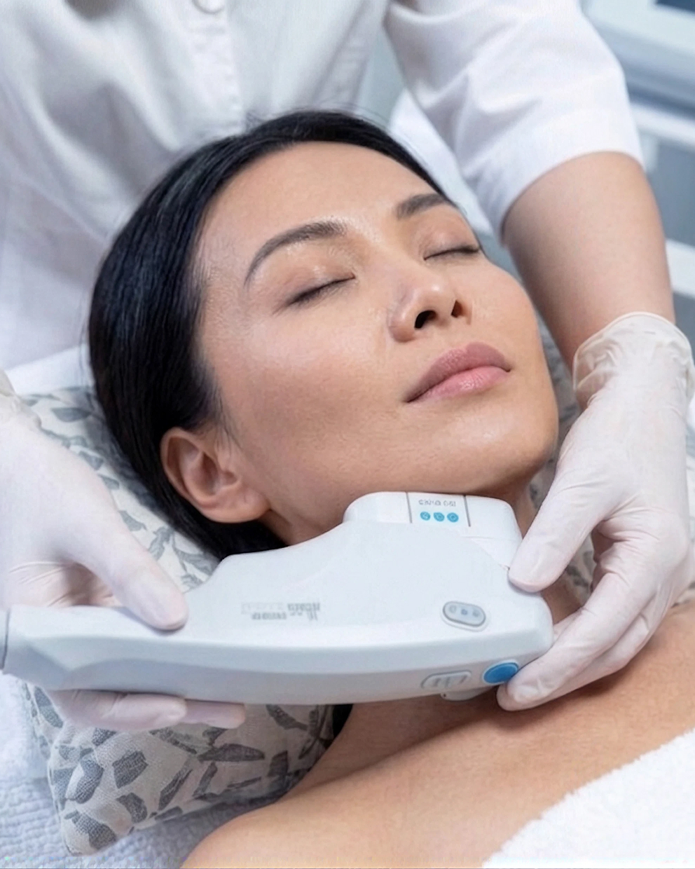 Ultherapy PRIME