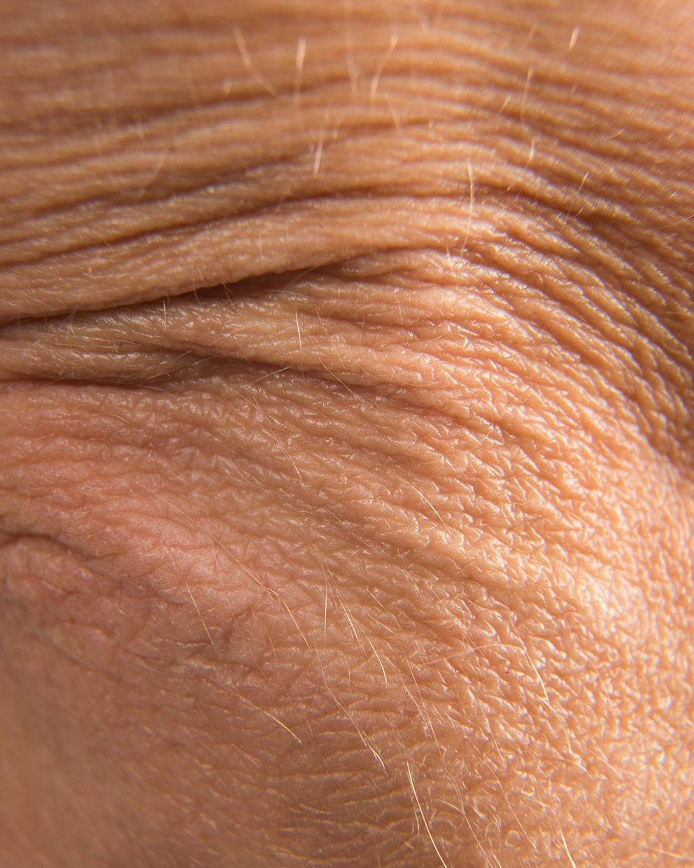 Macro close-up of deep horizontal forehead wrinkles